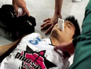 青少年癫痫病发作怎么办