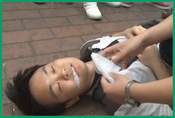 癫痫该怎么急救